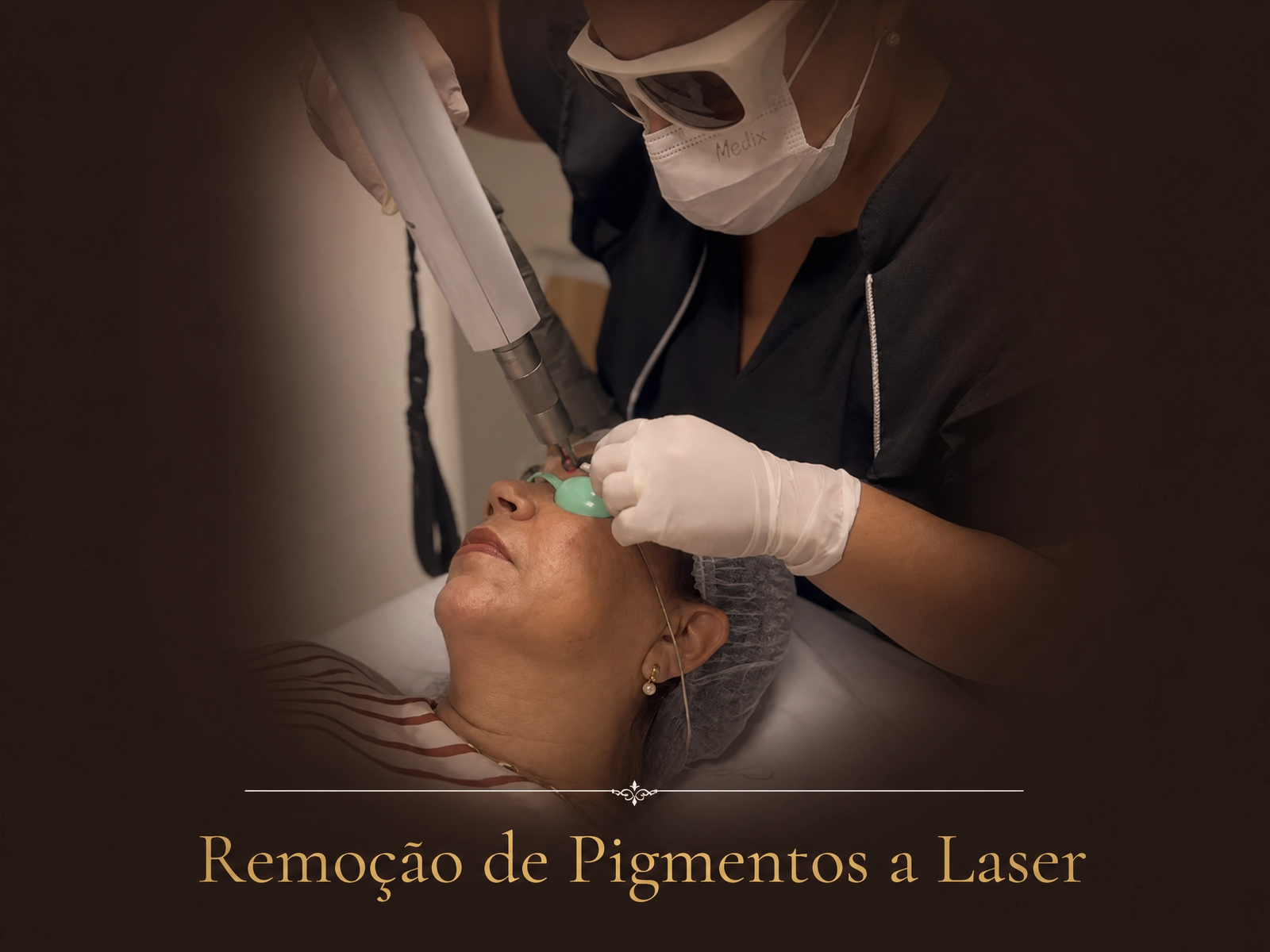 Remoção de Pigmentos a Laser